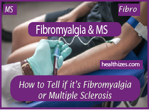 Fibromyalgia or Multiple Sclerosis