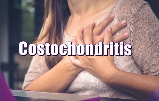 Costochondritis: Chest pain and fibromyalgia