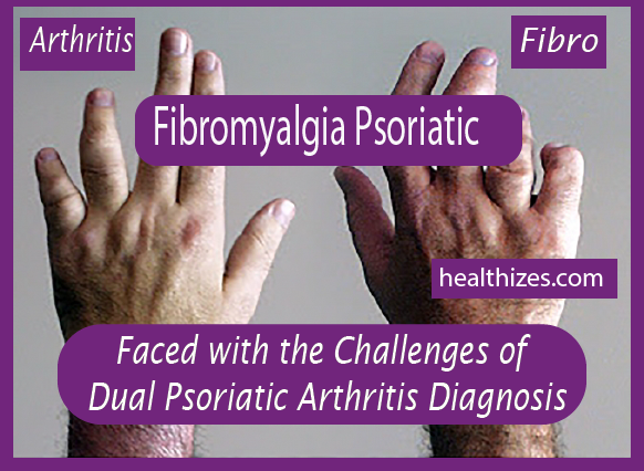 Faced with the Challenges of Dual Psoriatic Arthritis Diagnosis