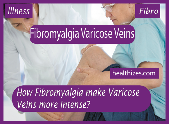 How Fibromyalgia make Varicose Veins more Intense