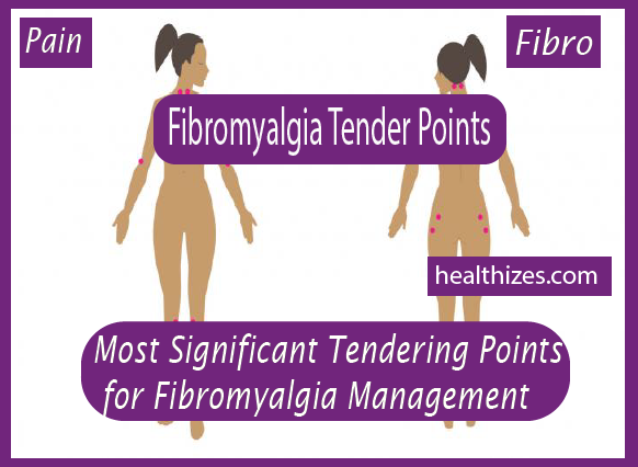 Most Significant Tendering Points for Fibromyalgia Management