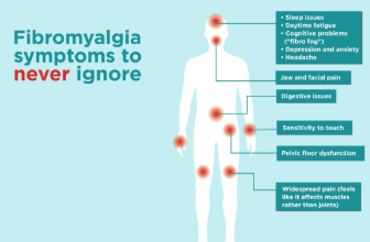 What is the Location of Fibromyalgia Pain?