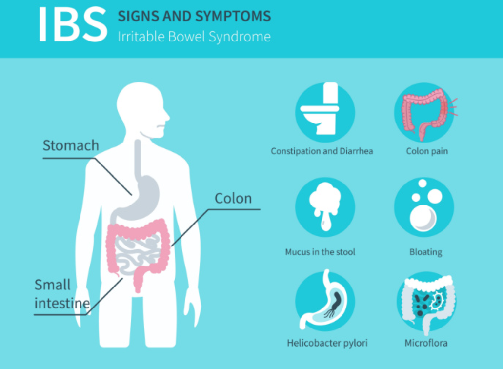 How does Fibromyalgia and Irritable Bowel Syndrome link?