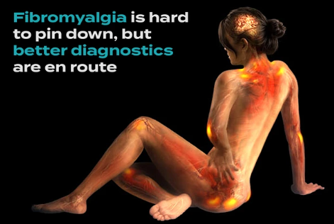 When Pain moves from your Head Down to the feet in Fibromyalgia