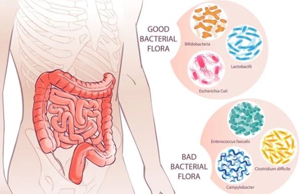 Hope for Millions of People with Fibromyalgia can Diagnose Faster than the New Gut Bacterial test