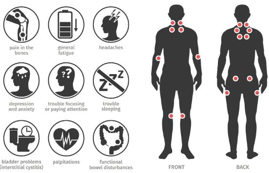 9 Early Fibromyalgia Signs Everyone Should Know and Understand them Quickly