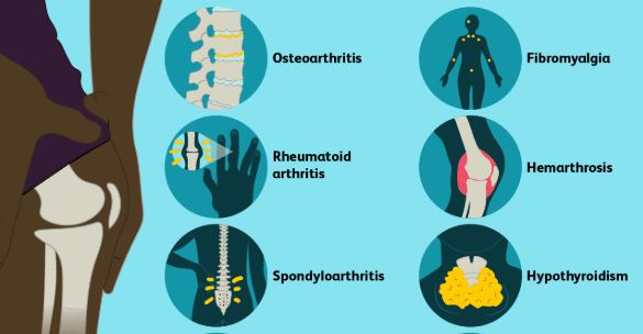 4 Things Your Joints are Telling you When they are in Pain – Chronic Awareness