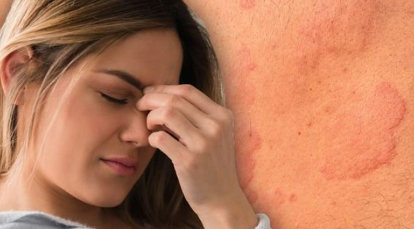 Why so many Skins Issues with Fibromyalgia?