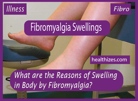 What are the Reasons of Swelling in Body by Fibromyalgia?