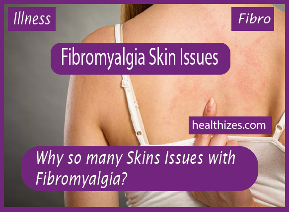 Why so many Skins Issues with Fibromyalgia?