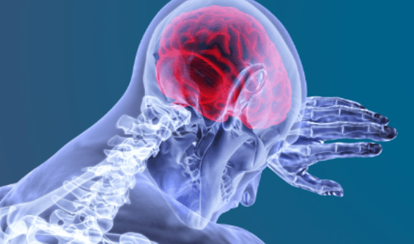 Can Brain Mapping Assistance to Locate the Fibromyalgia Source?