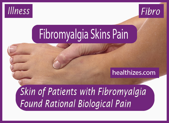 Skin of Patients with Fibromyalgia Found Rational Biological Source of Pain