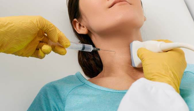 What is the Thyroid’s Fine Needle Aspiration?