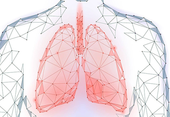 Study Shows Lungs Affected in Fibromyalgia Due to Nerve Damage