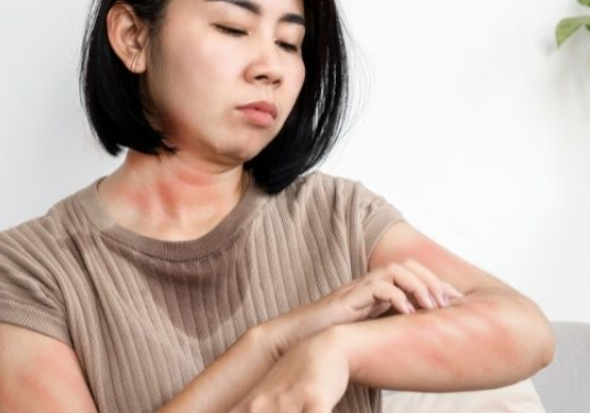 How to Treat Rash and Skin Problems with Fibromyalgia