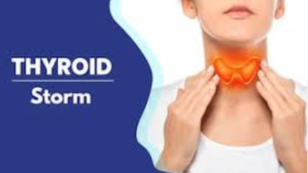 Why is thyroid Storm being a Life-Threatening Condition?