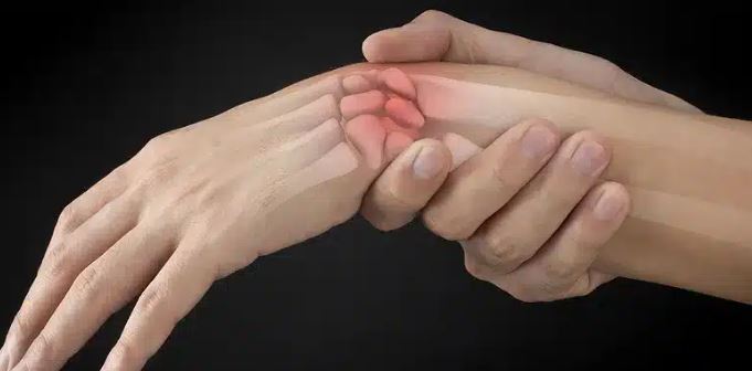 Arthritis in Your Wrist: Signs of Wrist Arthritis, and What to Do About It