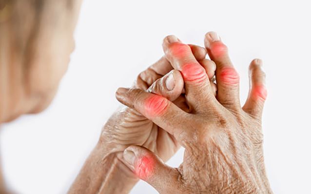 The Arthritis Symptoms That Matter to Patients May Not Always Be the Ones They Discuss with Their Doctor