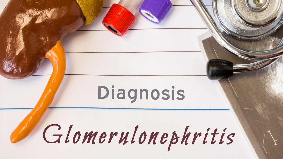 Can Fibromyalgia Lead to Glomerulonephritis? What is Glomerulonephritis?