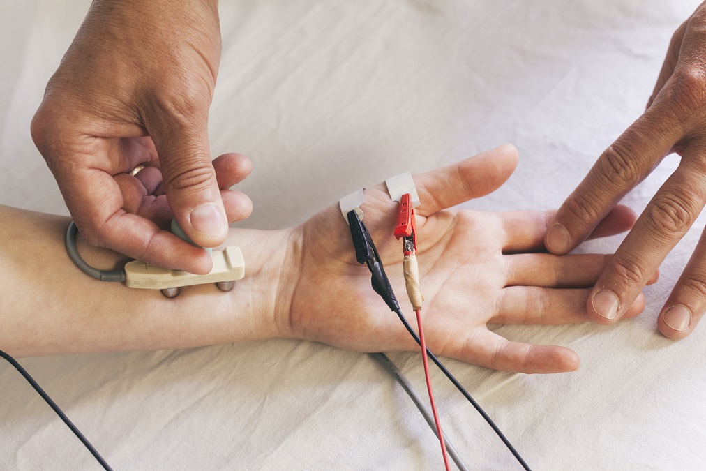 What is an EMG Nerve Conduction Study?