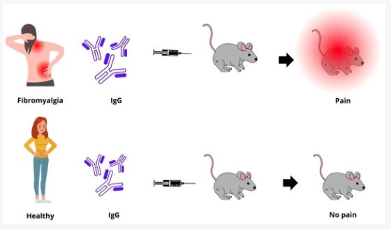 How Stress Triggers Fibromyalgia-Like Pain in Mice: Implications for Human Health