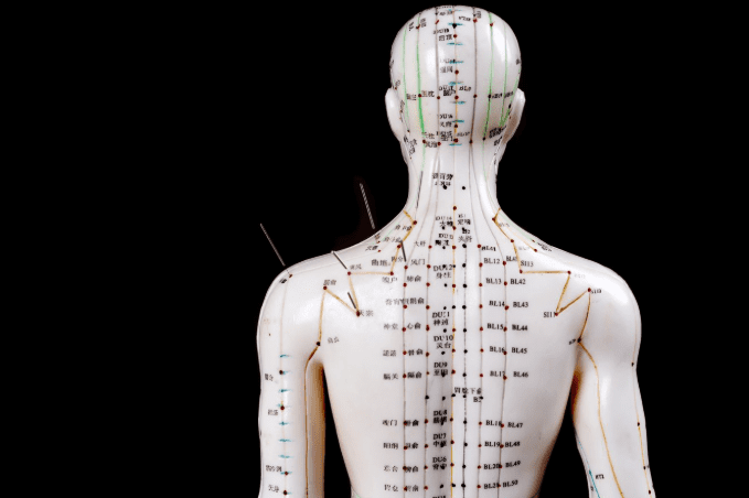 Acupuncture vs Fibromyalgia: Can Ancient Healing Relieve Modern Pain?