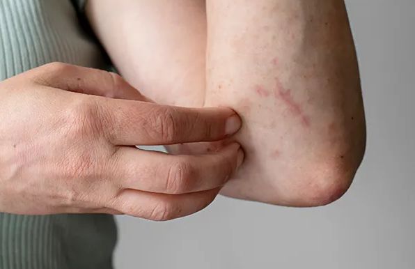 Recurrent Infections in Fibromyalgia: Understanding the Link