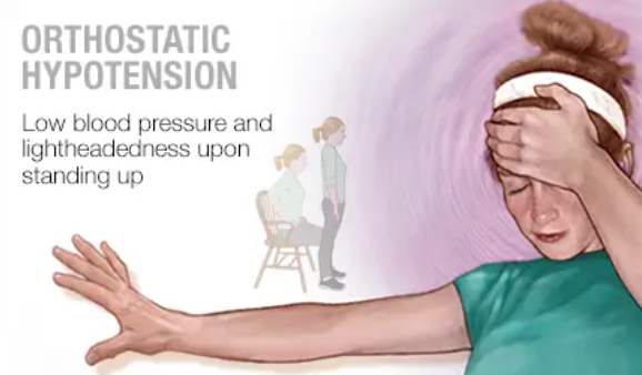 Dizziness Upon Standing (Orthostatic Hypotension) in Fibromyalgia