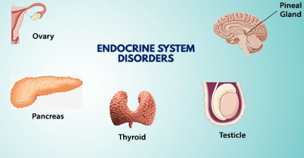 Endocrine Disease is Root Cause by Fibromyalgia: Unraveling the Connection