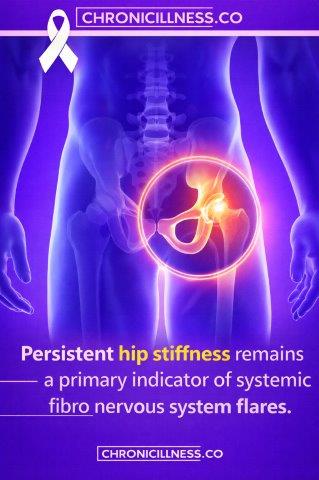 Fibromyalgia and Persistent Hip Stiffness
